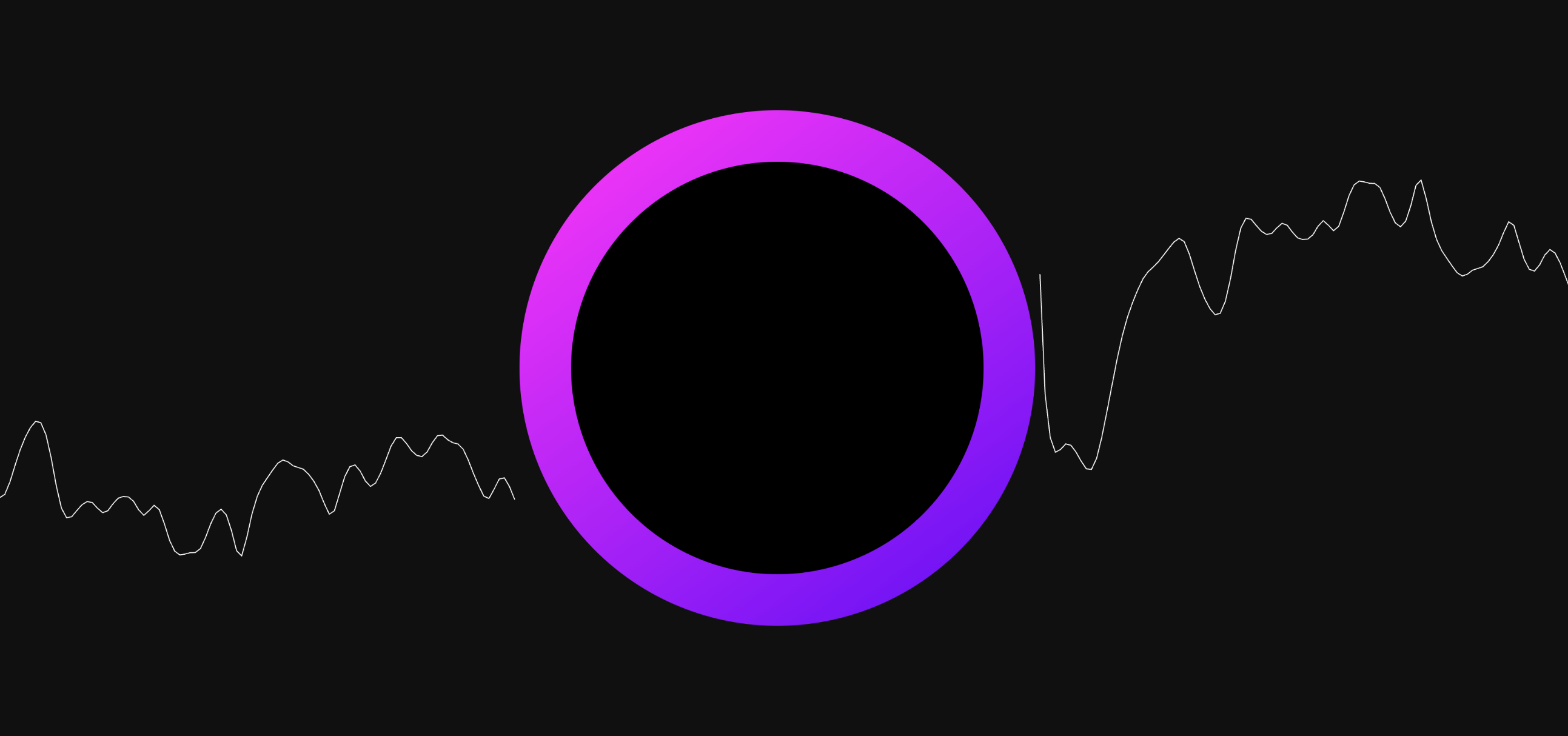 Audiogram